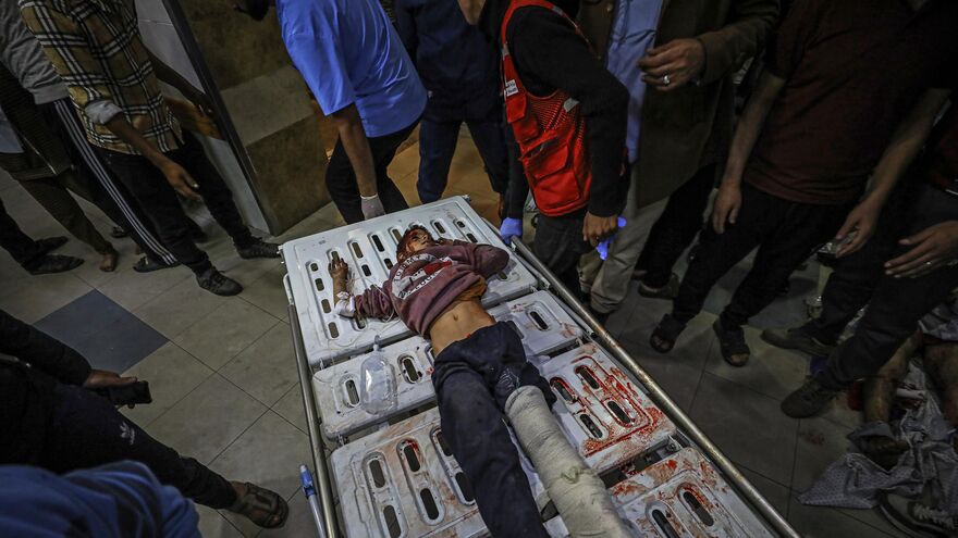 A Cry for Life… Innocent Pain Under Bombardment