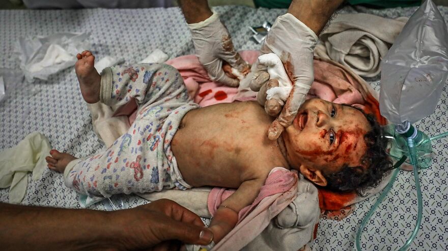 A Cry for Life… Innocent Pain Under Bombardment